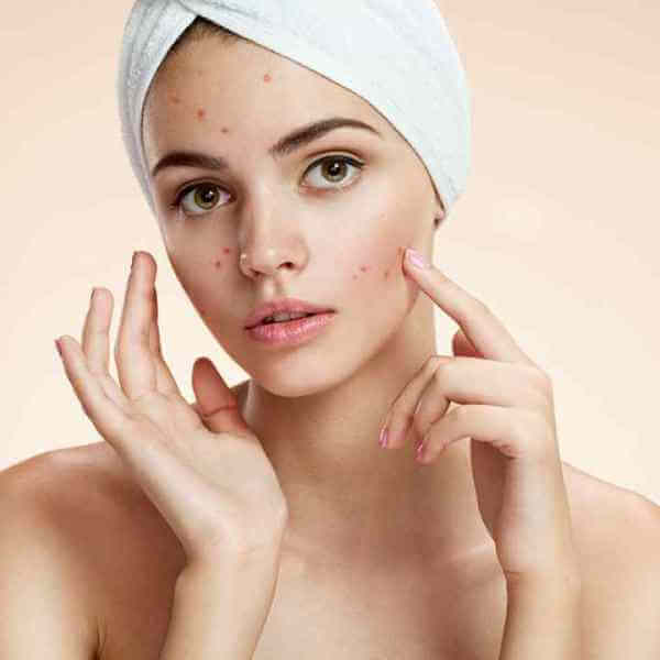 Purge your skin – Alles muss raus!