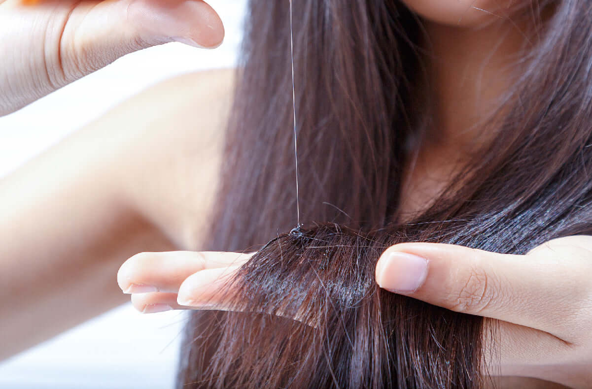 Haarausfall verstehen