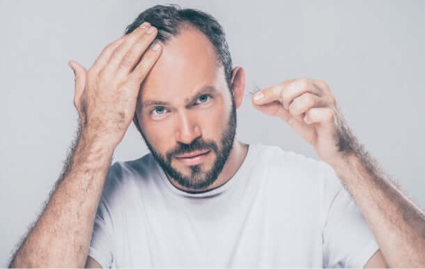 Haarausfall beim Mann