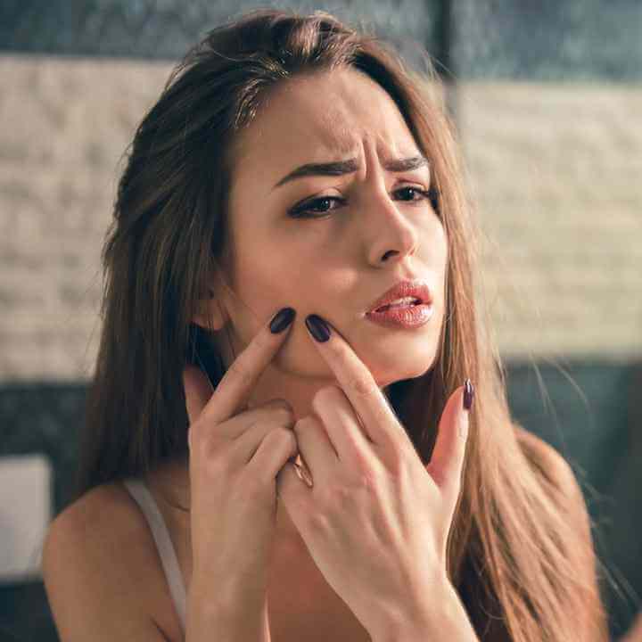 Nicht-komedogene Kosmetik: Keine Chance für Hautunreinheiten!